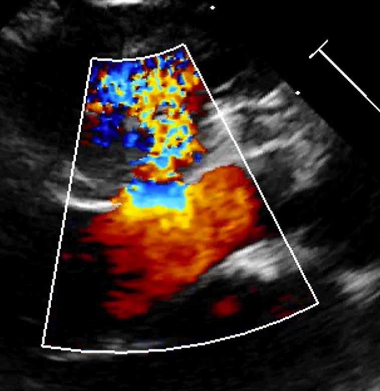 Difetto del setto interventricolare nel cane e nel gatto